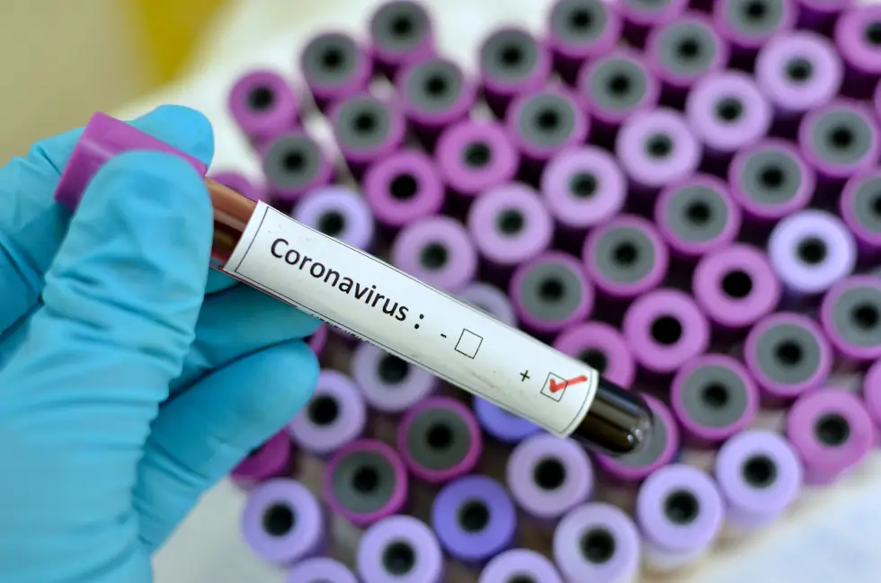 Coronavirus Sample Viles Coronavirus Sample Viles